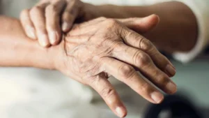parkinson hastalığı